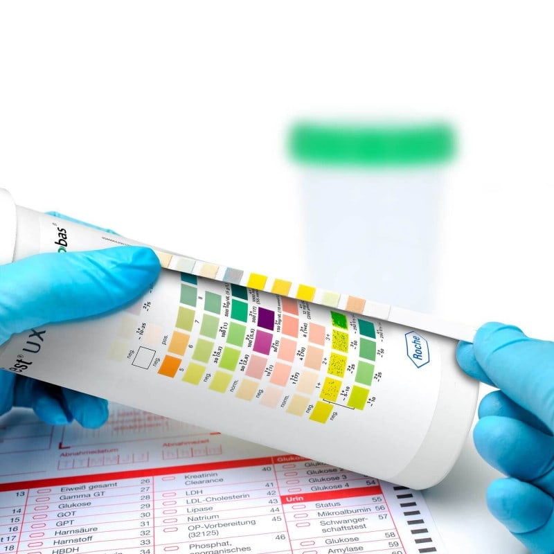 Combur Test UX Medvana UK