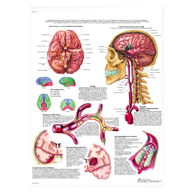 Stroke Wall Chart German Medvana UK