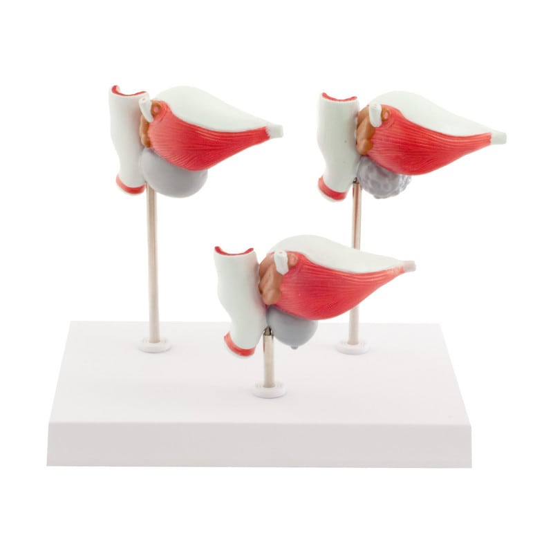 3-Part Prostate Disease Model Medvana UK