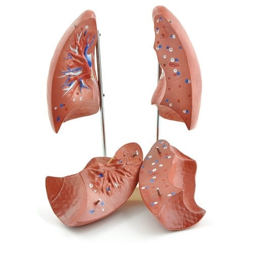 Lung Model Medvana UK