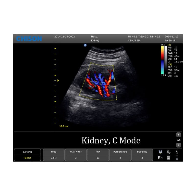 CHISON ECO5 Ultrasound Machine with Color Doppler + linear transducer Medvana UK