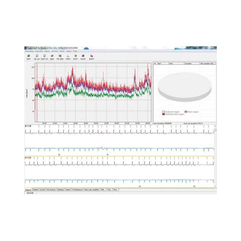 GE SEER 1000 Multi-Channel Digital Holter Recorder without software Medvana UK