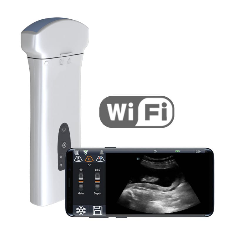 Youkey D8 Mobile Ultrasound Machine black-white | without transducer