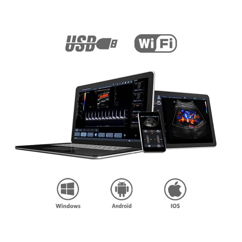 Youkey D8 Mobile Ultrasound Machine black-white | without transducer