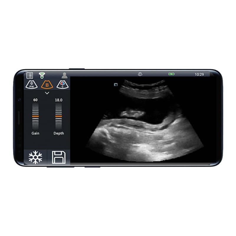 Youkey D8 Mobile Ultrasound Machine black-white | without transducer