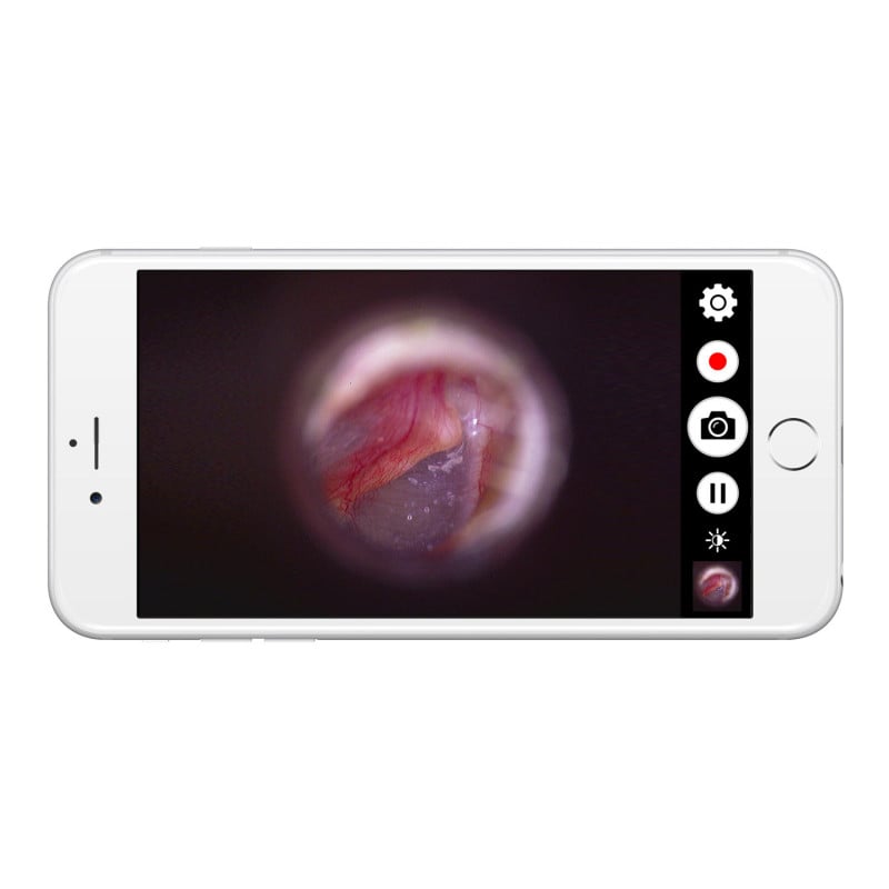 Firefly DE570 W-LAN HD Digital Otoscope Medvana UK