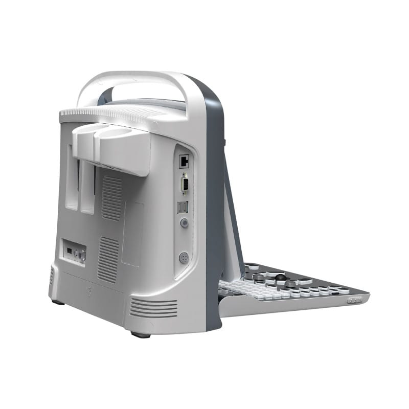 CHISON ECO1 incl. Ultrasound Trolley without battery | with convex probe Medvana UK