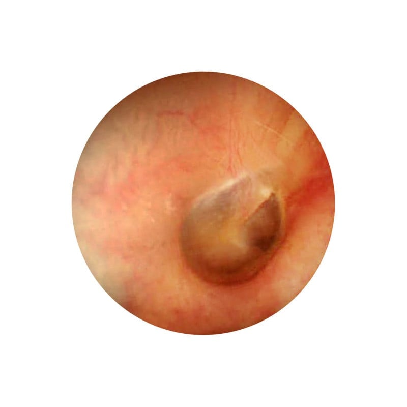 LuxaScope Auris CCT black Medvana UK