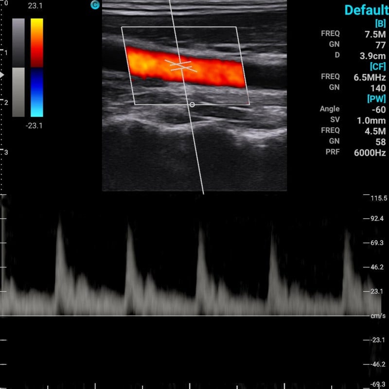 Chison Portable Ultrasound Machine “SonoEye” P3 (with 3.0 MHz phased array transducer) Medvana UK
