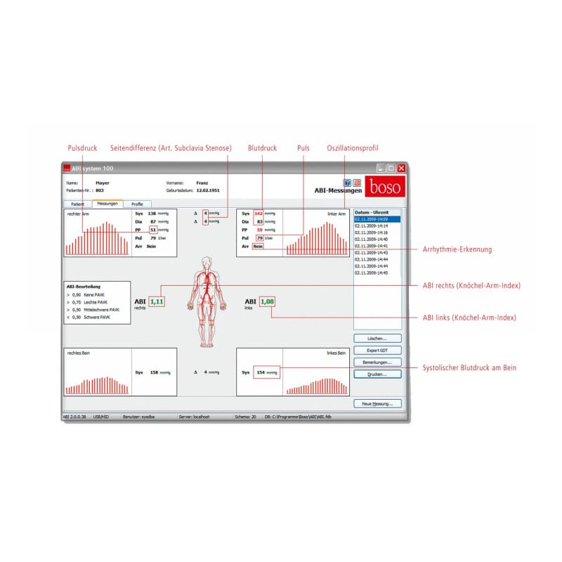 boso ABI System 100 Standard | silver Medvana UK
