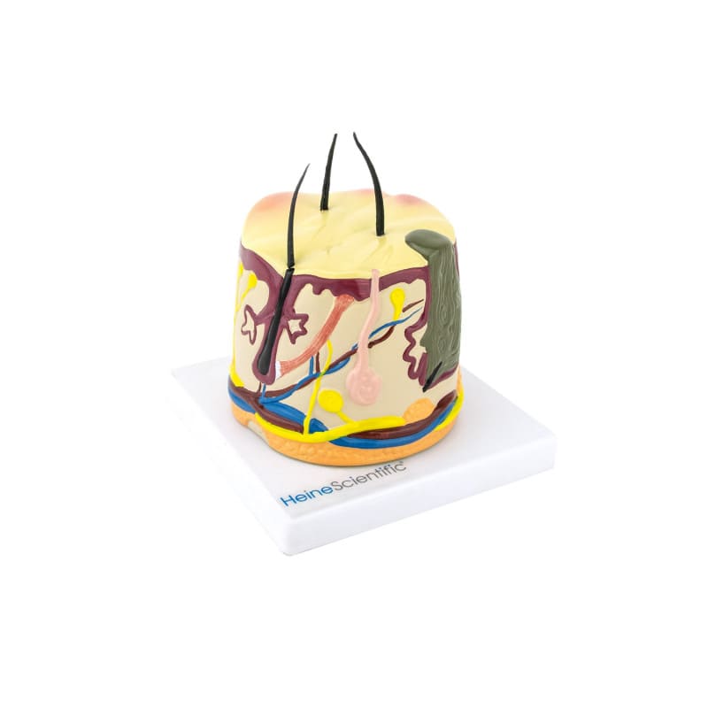 Acne Model Medvana UK