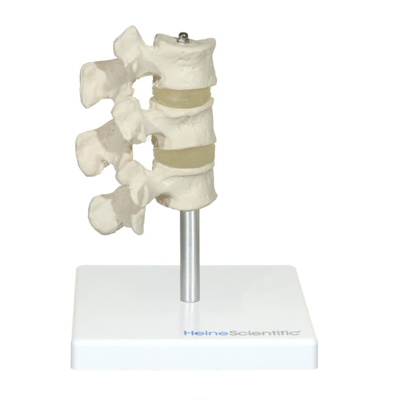 Osteoporosis Model Medvana UK