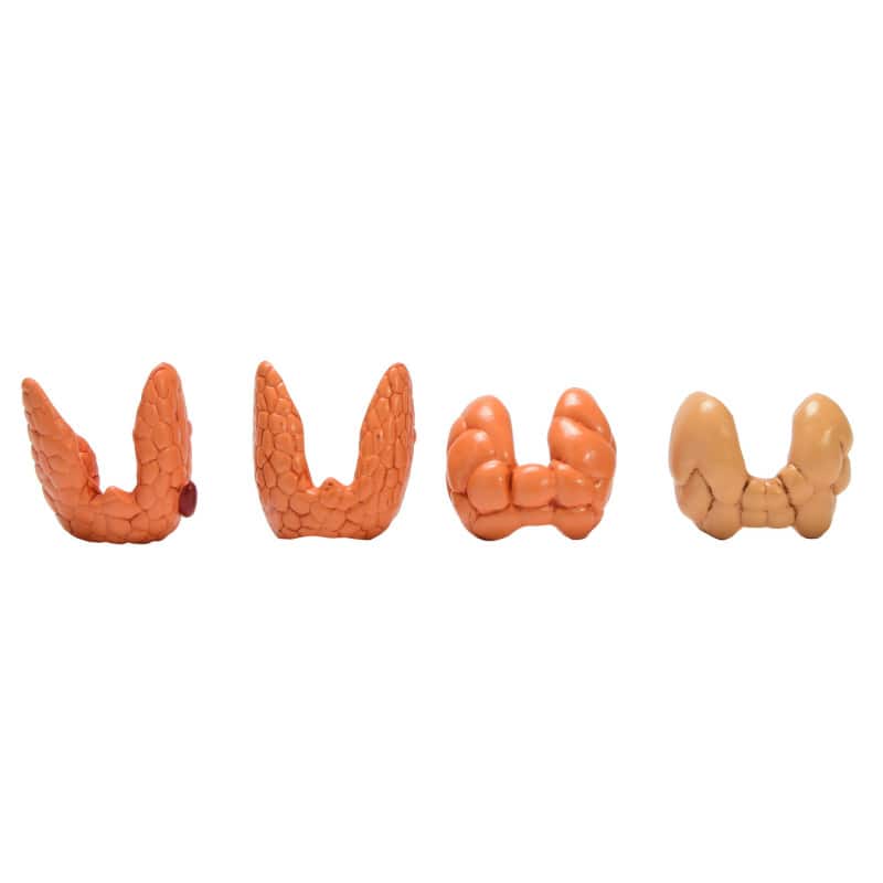 Thyroid Diseases Model Medvana UK