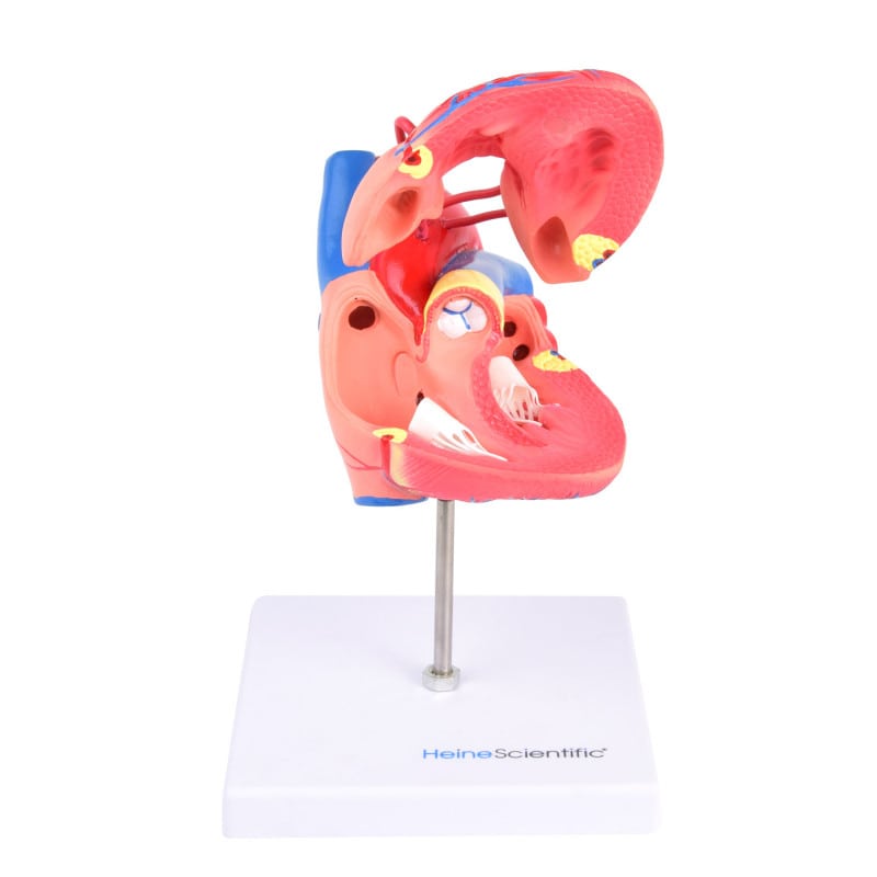Heart Model with Bypass Medvana UK