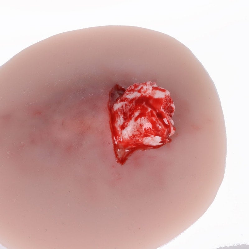 Wound Moulage Open Fracture Ankle