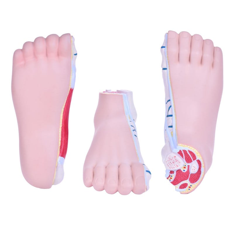 Model of Foot Malpositions Medvana UK