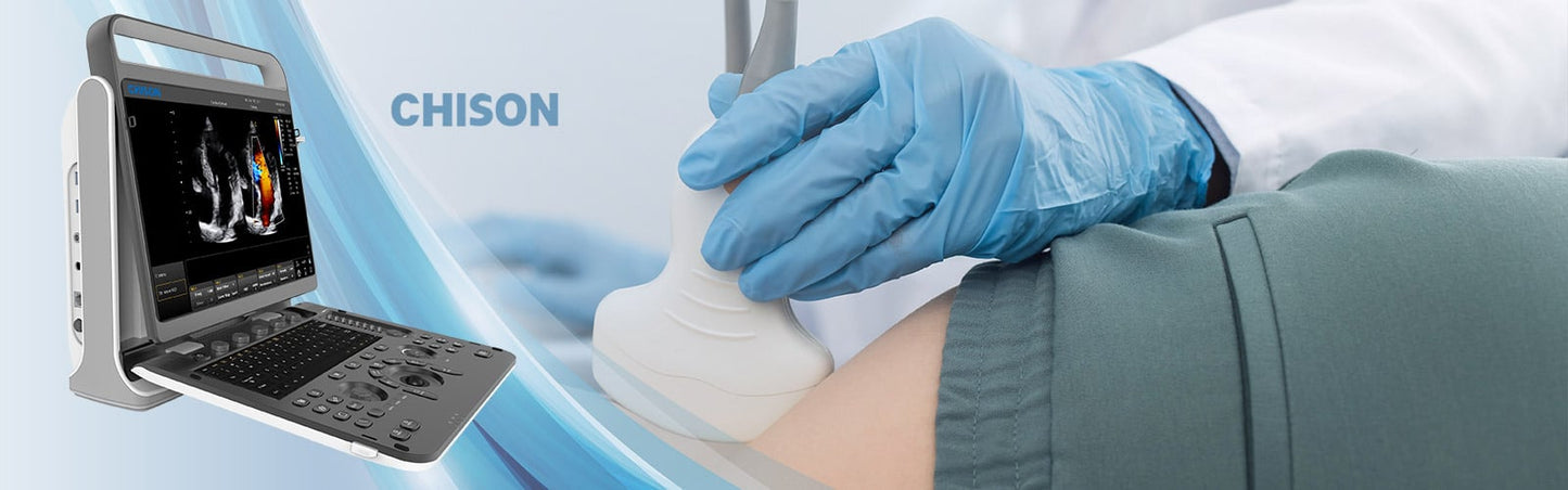 Chison EBit 60 Ultrasound System incl. ultrasound trolley (without height adjustment) Medvana UK