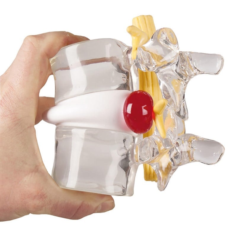 Herniated Disc Simulator Medvana UK