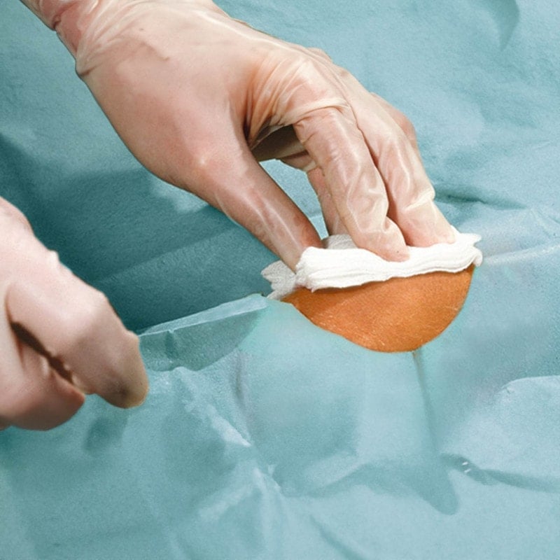 Foliodrape® Fenestrated Drapes, self-adhesive 170 x 250 cm (Ø 10 cm) Medvana UK