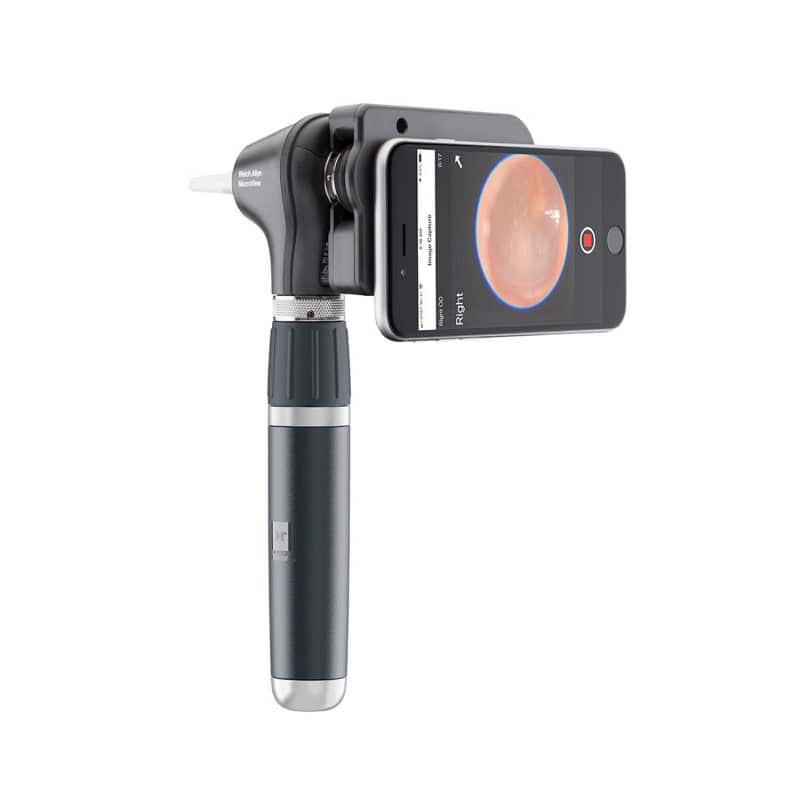 MacroView Plus Otoscope for iExaminer Medvana UK