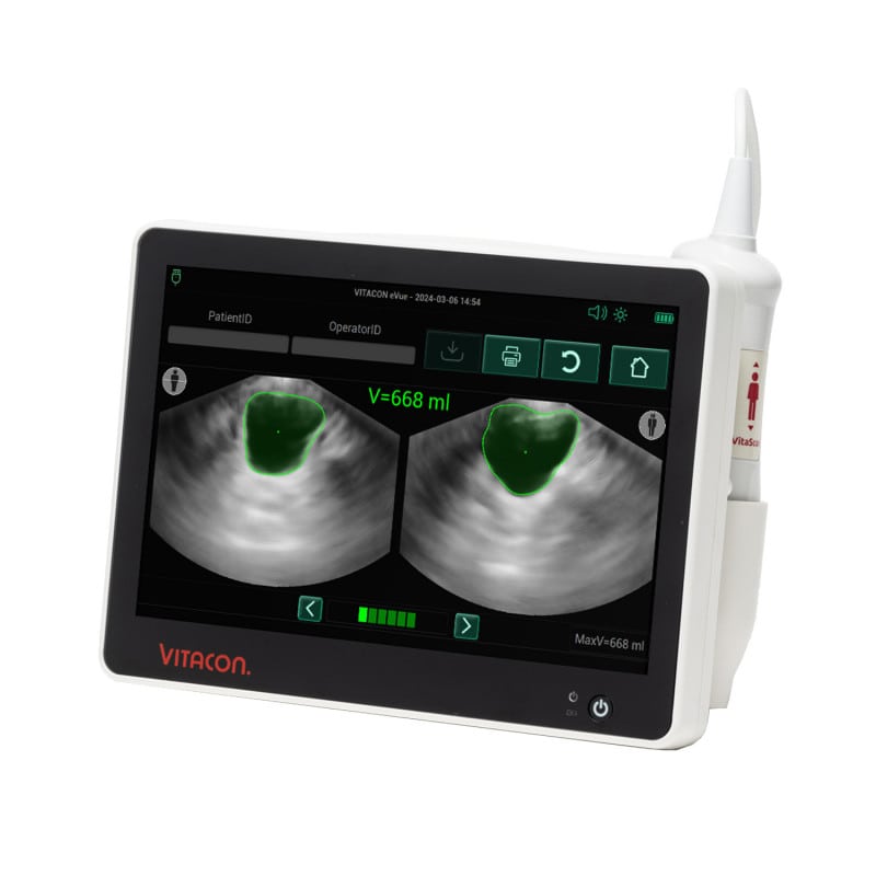 Vitascan eVue Bladder Scanner Medvana UK
