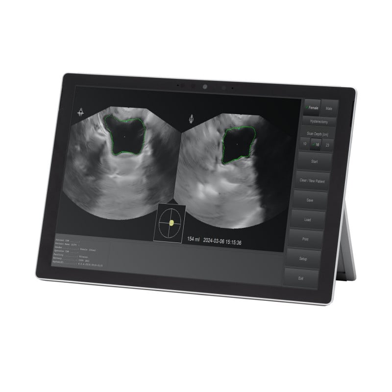 Vitascan LT Bladder Scanner with Microsoft Surface Tablet