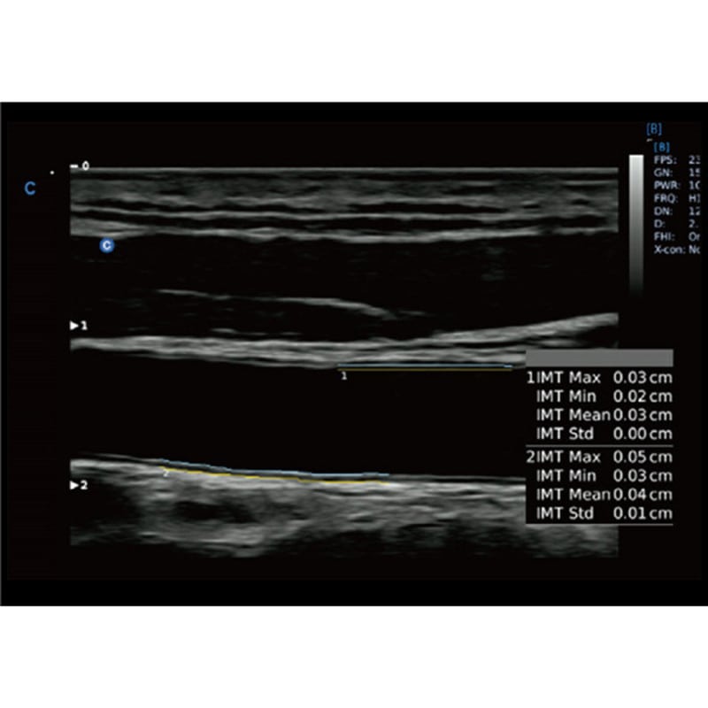 CBit6 Ultrasound Machine with battery Medvana UK