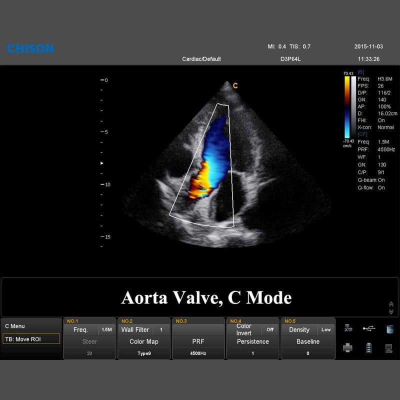 QBit 7 Ultrasound System Medvana UK