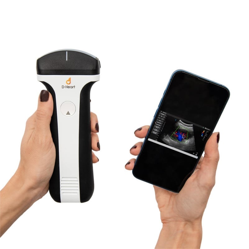 D-Heart Handheld Ultrasound Scanner linear | with tablet Medvana UK