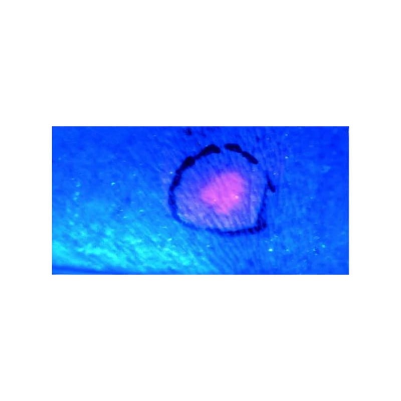 Wood's Lamp Medvana UK