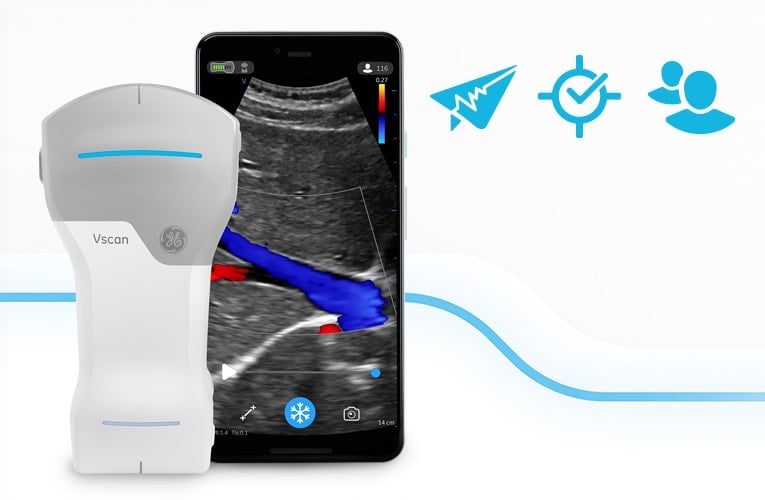 Vscan Air™ CL Ultrasound System