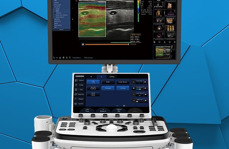 XBit 80 Color Doppler Ultrasound System with battery