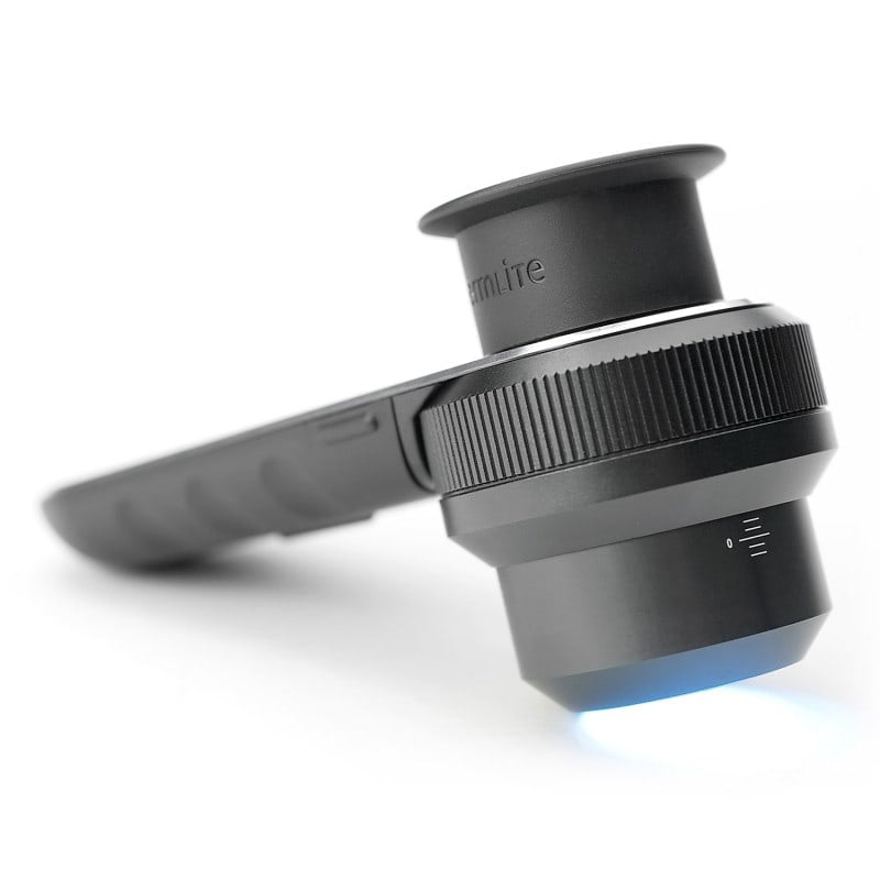 DermLite DL3N Dermatoscope Medvana UK