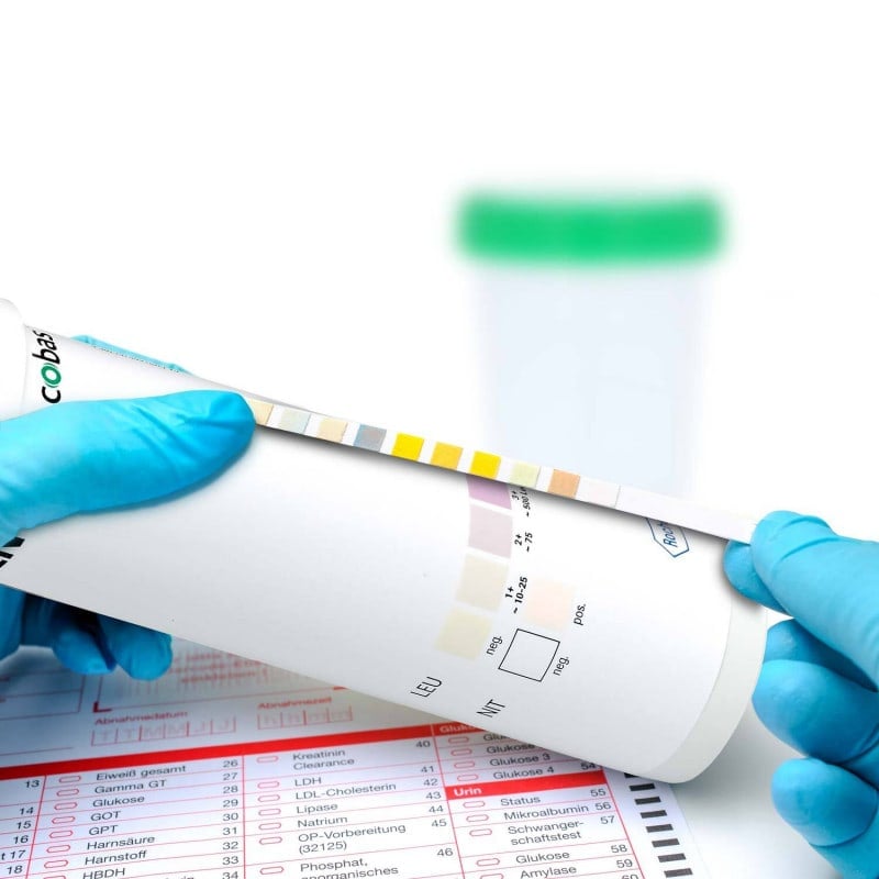 Combur 2 Test LN, 50 pcs. Medvana UK