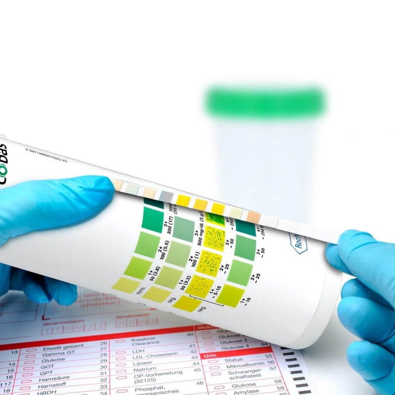 Combur 3 Test E, 50 PCS Medvana UK