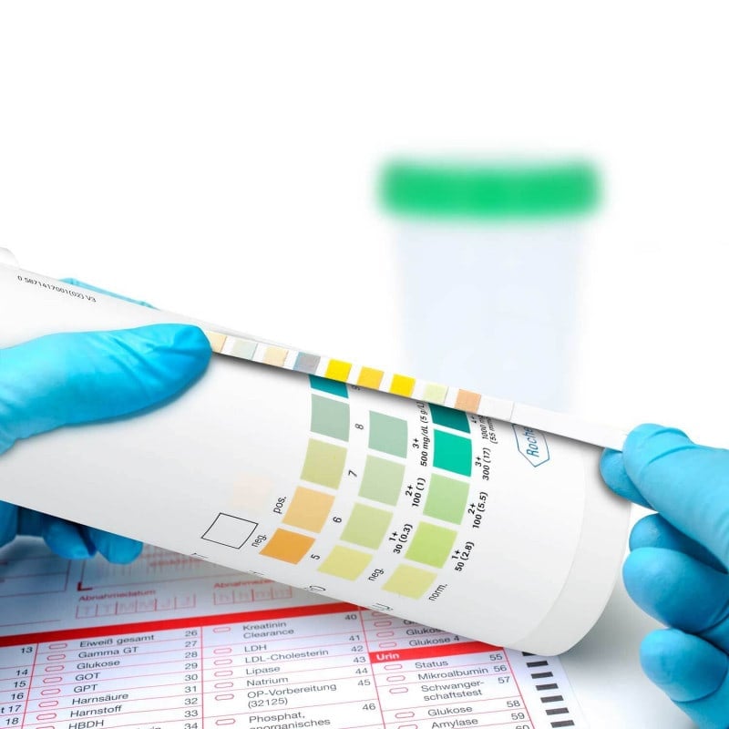 Combur 4 Test N, 50 PCS Medvana UK