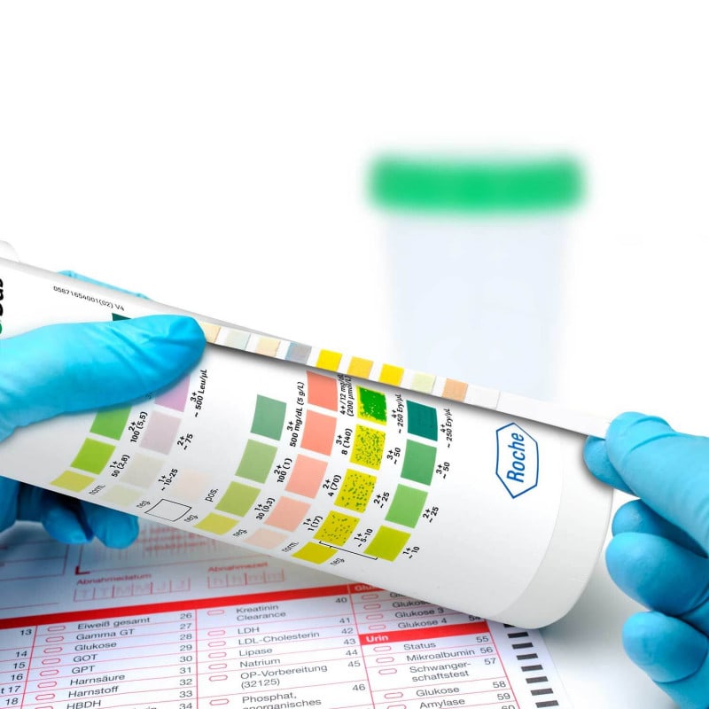 Combur 6 Test, 50 PCS Medvana UK