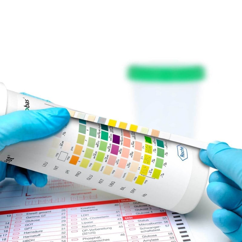 Combur 9 Test 50 strips Medvana UK