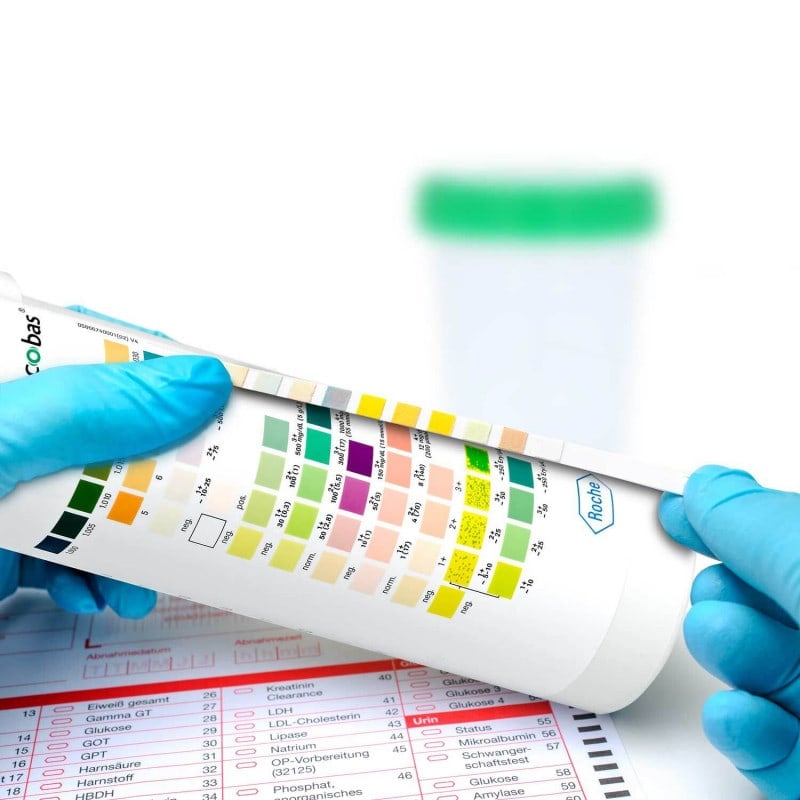 Combur 10 Test, 100 pcs. Medvana UK