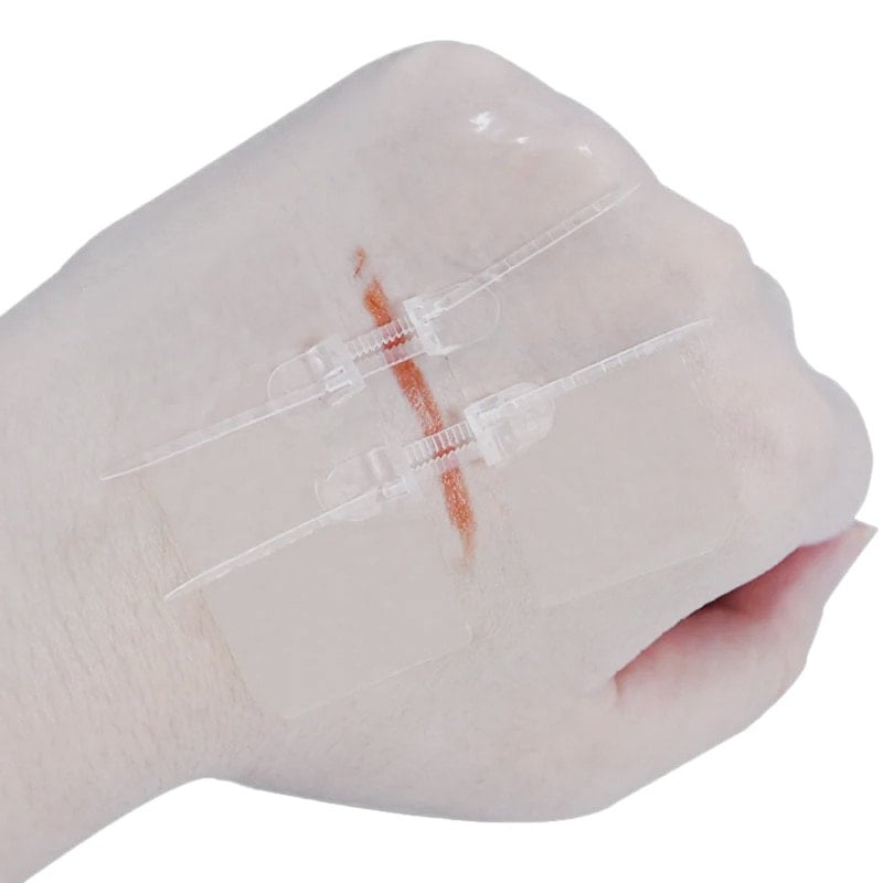 Zip Wound Closure Device G1 6 x 20 cm Medvana UK
