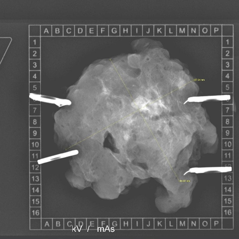 KLINITRAY™ Mammary Plates R | Large Medvana UK