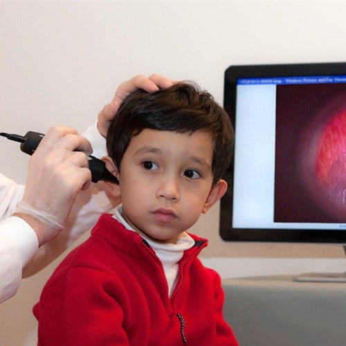 Firefly Video Otoscope DE550 (wireless transfer) Medvana UK