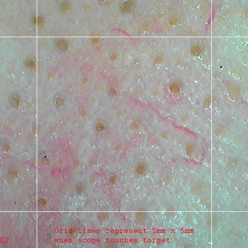 Firefly DE370 HD Mobile Wireless Polarizing Dermatoscope Medvana UK