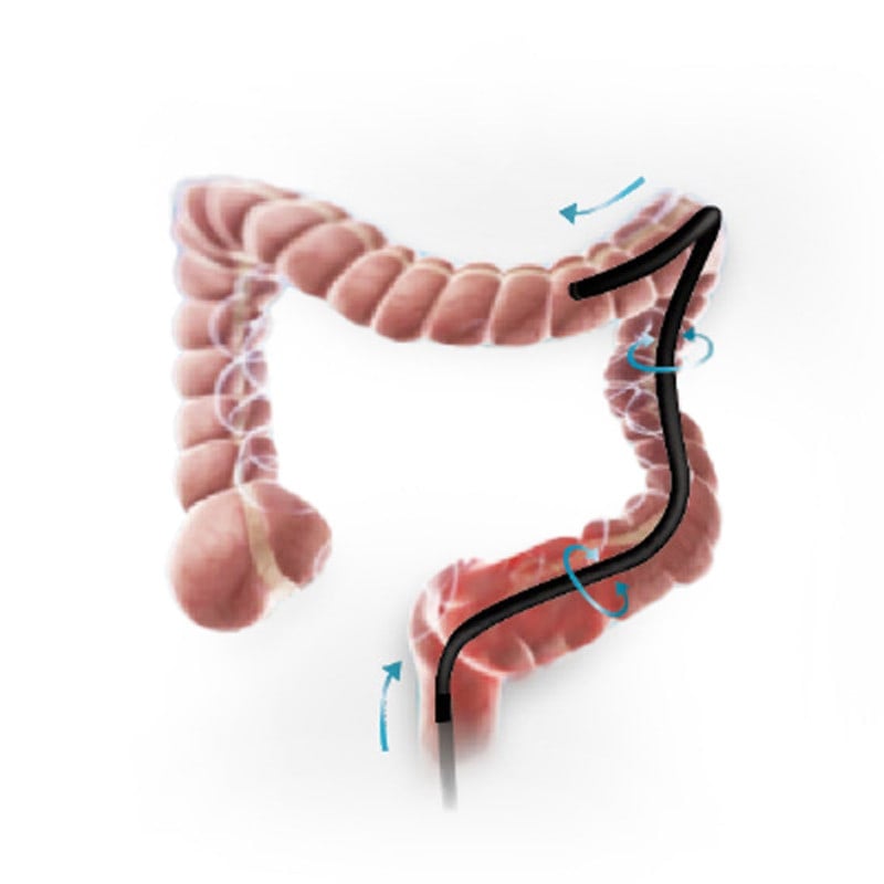 HD-500 Video Colonoscope EC-500L-T Medvana UK