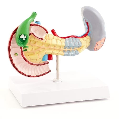 Pancreas, Spleen & Gallbladder Model with Diseases Medvana UK