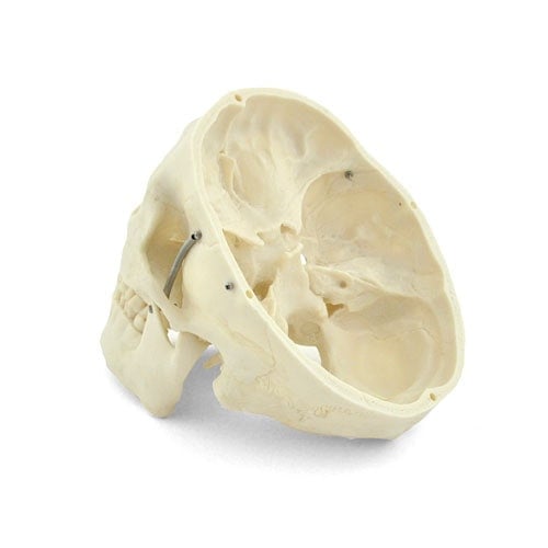 Human Skull Model Medvana UK