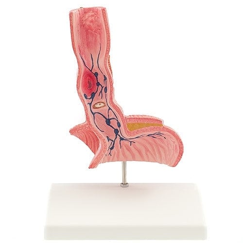 Oesophagus Model Medvana UK