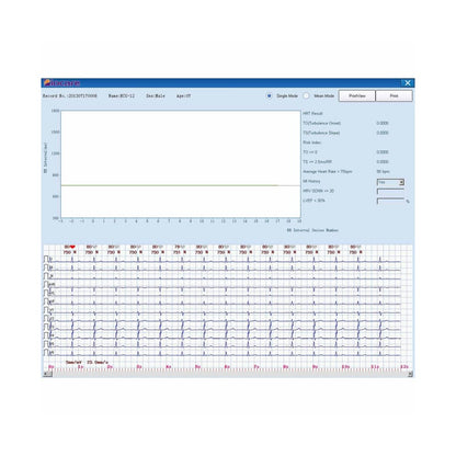 PC ECG Biocare ECG-2000 Medvana UK