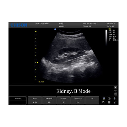 CHISON ECO5 incl. Ultrasound Trolley with linear probe Medvana UK