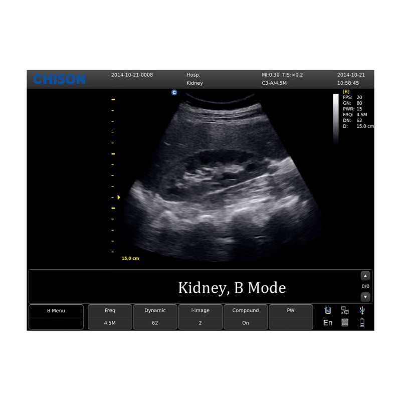 CHISON ECO5 incl. Ultrasound Trolley with convex probe Medvana UK